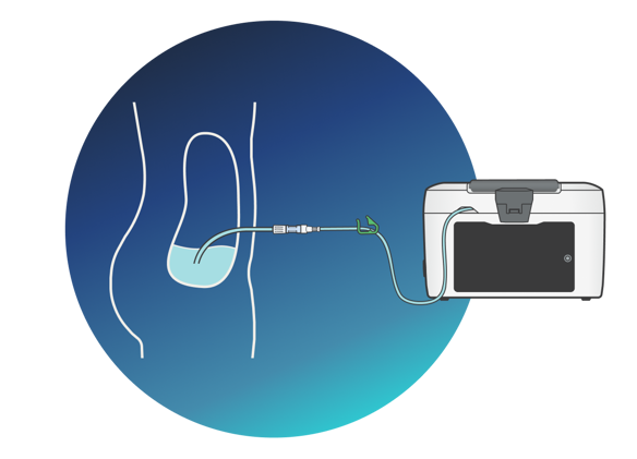 PD treatment